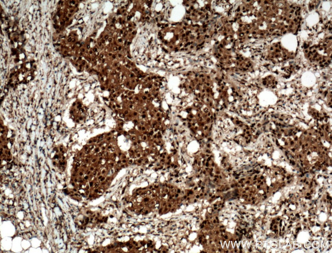 RAD23B Antibody in Immunohistochemistry (Paraffin) (IHC (P))