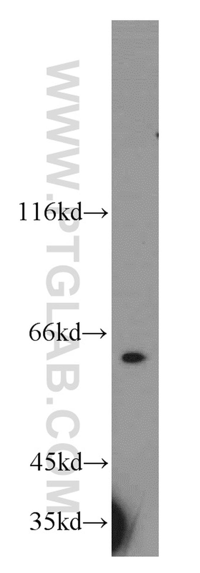 RAD23B Antibody in Western Blot (WB)