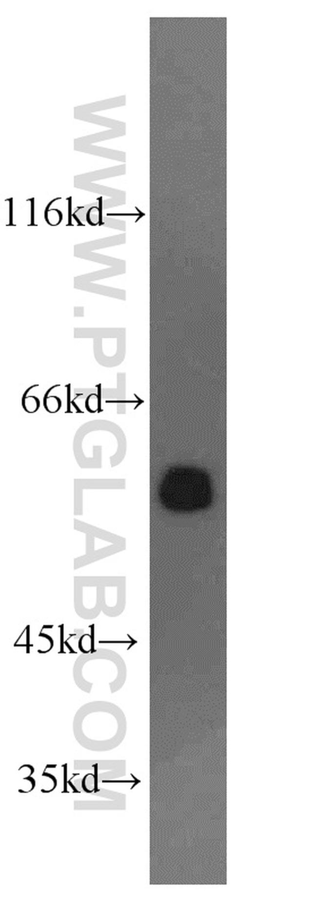 RAD23B Antibody in Western Blot (WB)