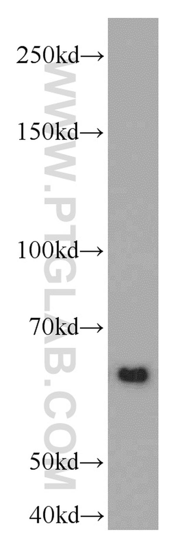 RAD23B Antibody in Western Blot (WB)