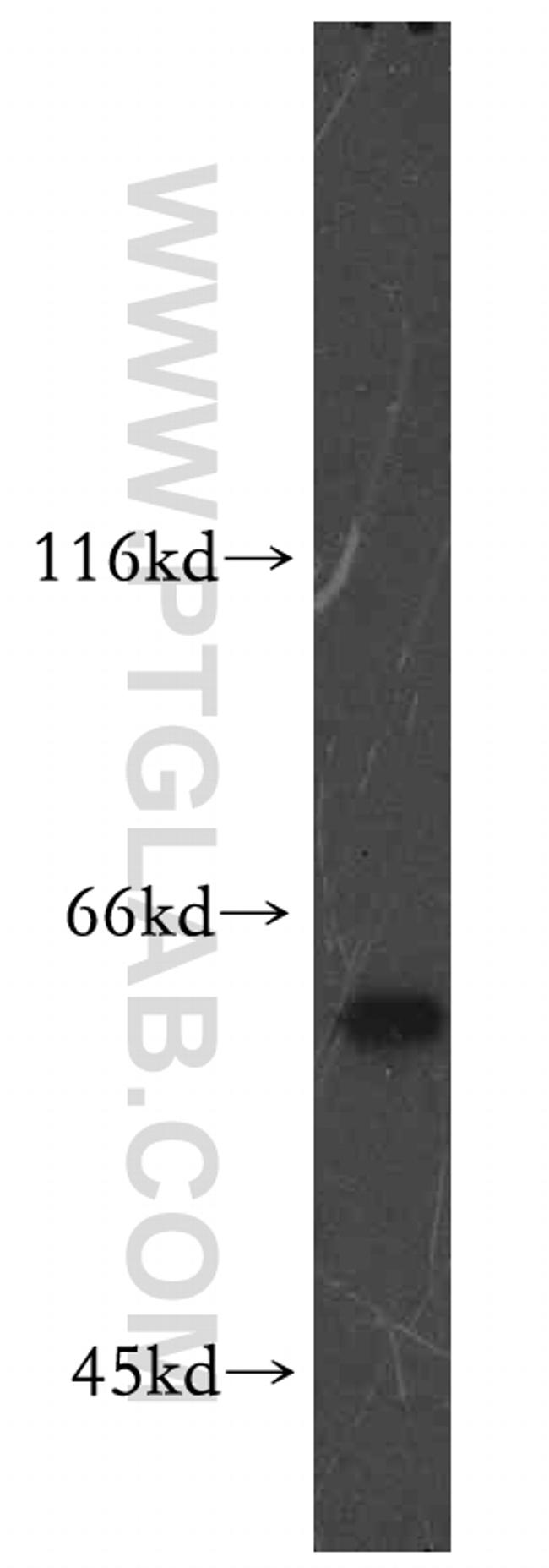 RAD23B Antibody in Western Blot (WB)