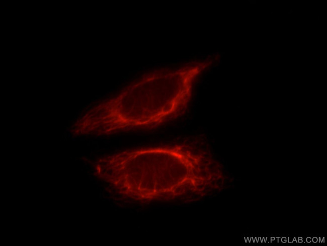 WSB2 Antibody in Immunocytochemistry (ICC/IF)