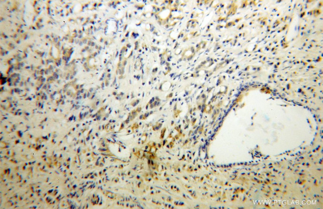 WSB2 Antibody in Immunohistochemistry (Paraffin) (IHC (P))