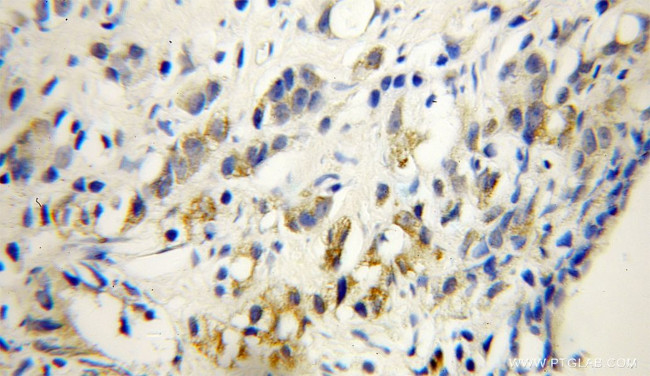 WSB2 Antibody in Immunohistochemistry (Paraffin) (IHC (P))