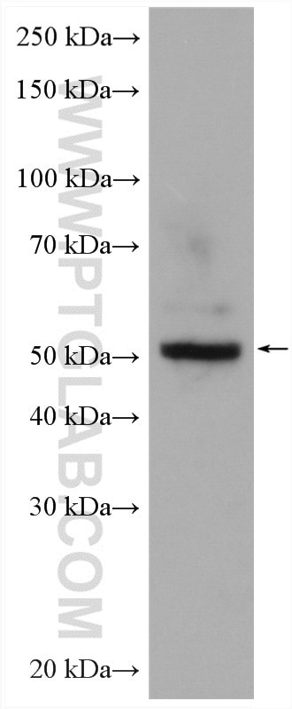 WSB2 Antibody in Western Blot (WB)