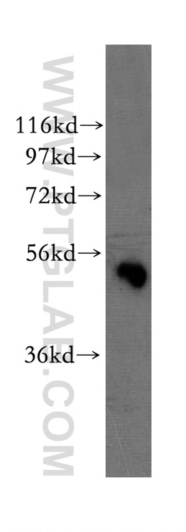 WSB2 Antibody in Western Blot (WB)