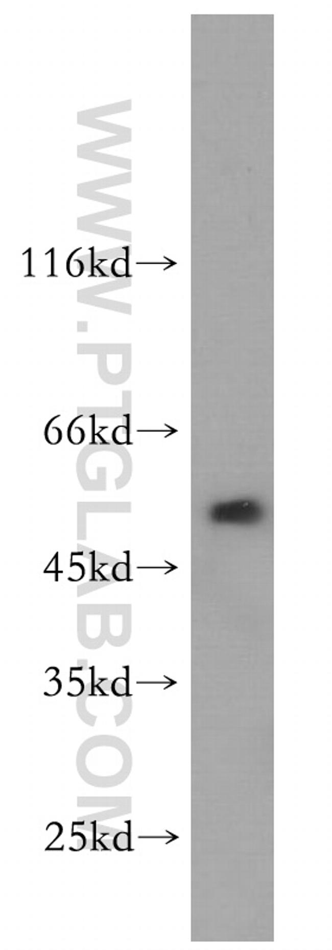 WSB2 Antibody in Western Blot (WB)