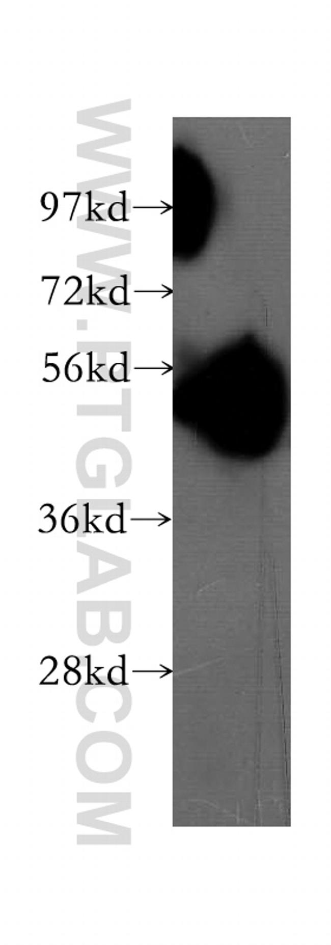 WSB2 Antibody in Western Blot (WB)