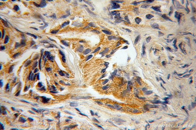 RAB22A Antibody in Immunohistochemistry (Paraffin) (IHC (P))