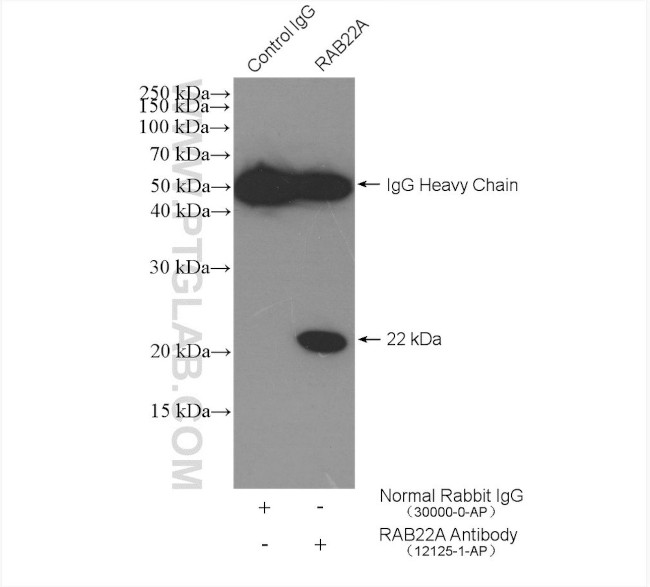 RAB22A Antibody in Immunoprecipitation (IP)