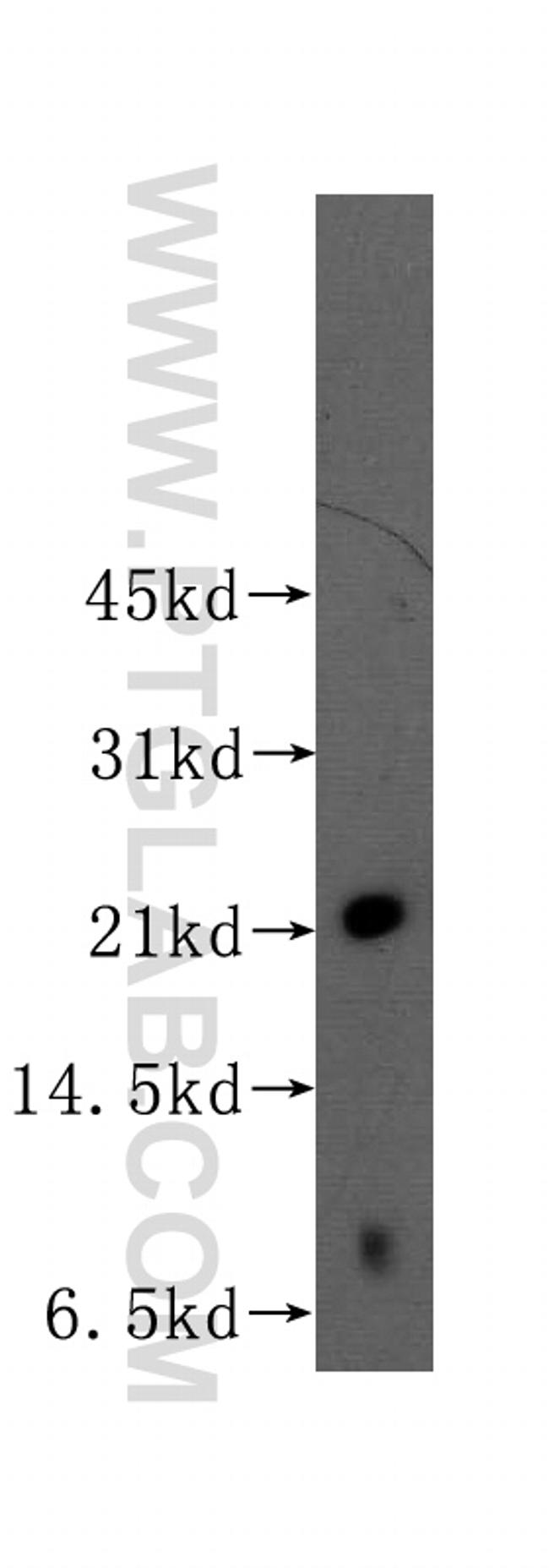 RAB22A Antibody in Western Blot (WB)