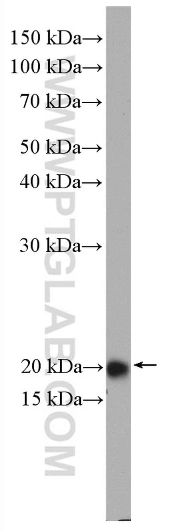 RAB22A Antibody in Western Blot (WB)