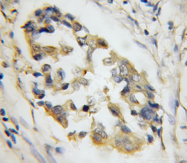 SYTL4 Antibody in Immunohistochemistry (Paraffin) (IHC (P))