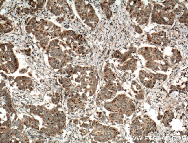 SYTL4 Antibody in Immunohistochemistry (Paraffin) (IHC (P))