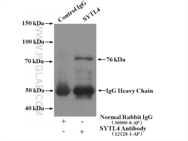 SYTL4 Antibody in Immunoprecipitation (IP)