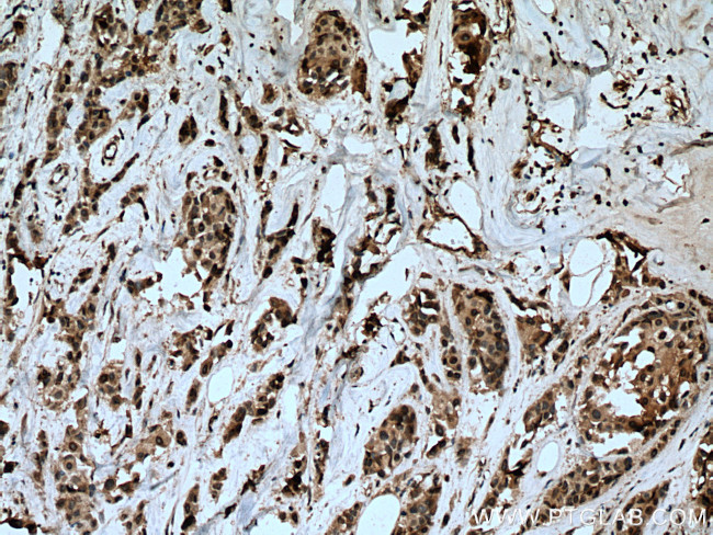 SNAI2 Antibody in Immunohistochemistry (Paraffin) (IHC (P))