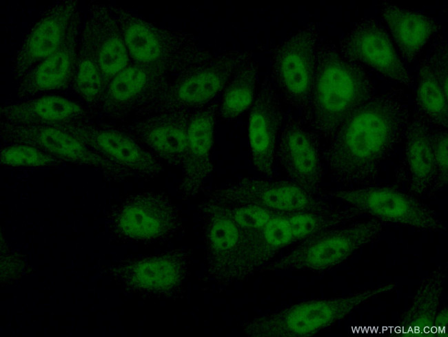 SAP130 Antibody in Immunocytochemistry (ICC/IF)