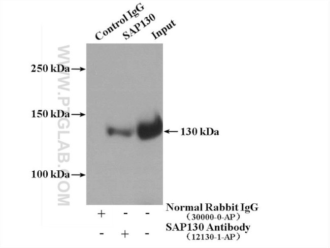 SAP130 Antibody in Immunoprecipitation (IP)