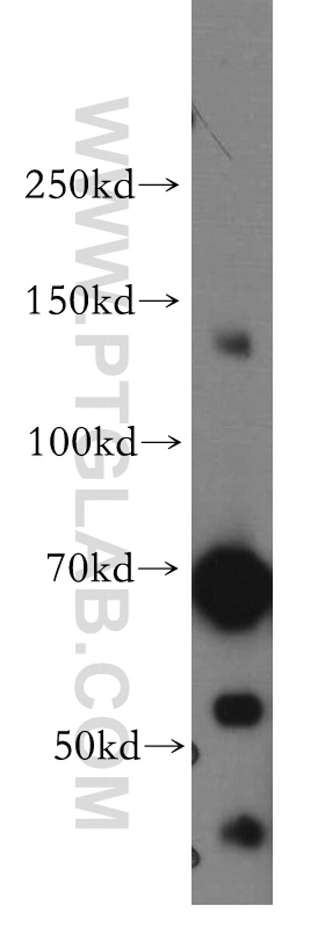 SAP130 Antibody in Western Blot (WB)