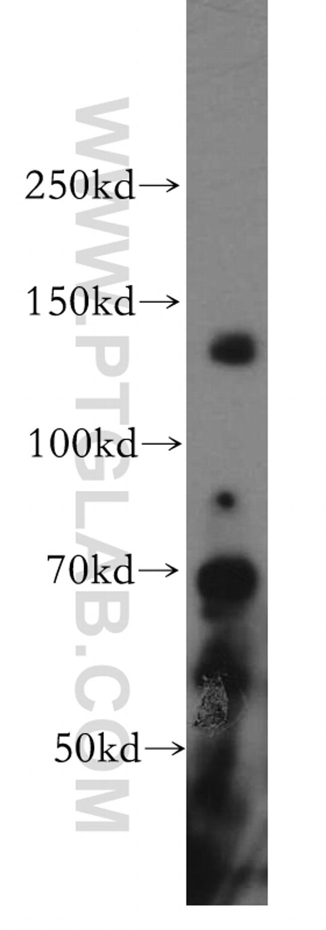 SAP130 Antibody in Western Blot (WB)