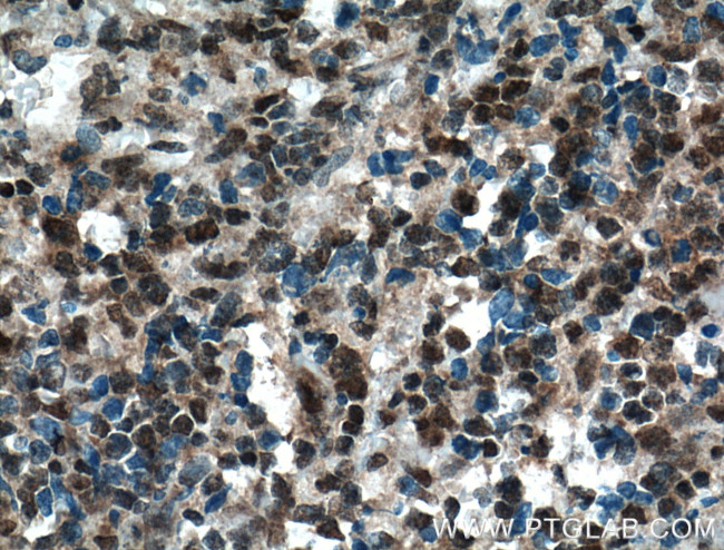 TIA1 Antibody in Immunohistochemistry (Paraffin) (IHC (P))