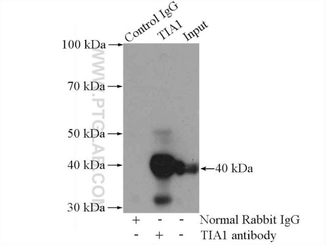 TIA1 Antibody in Immunoprecipitation (IP)