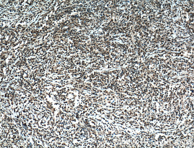 TIA1 Antibody in Immunohistochemistry (Paraffin) (IHC (P))