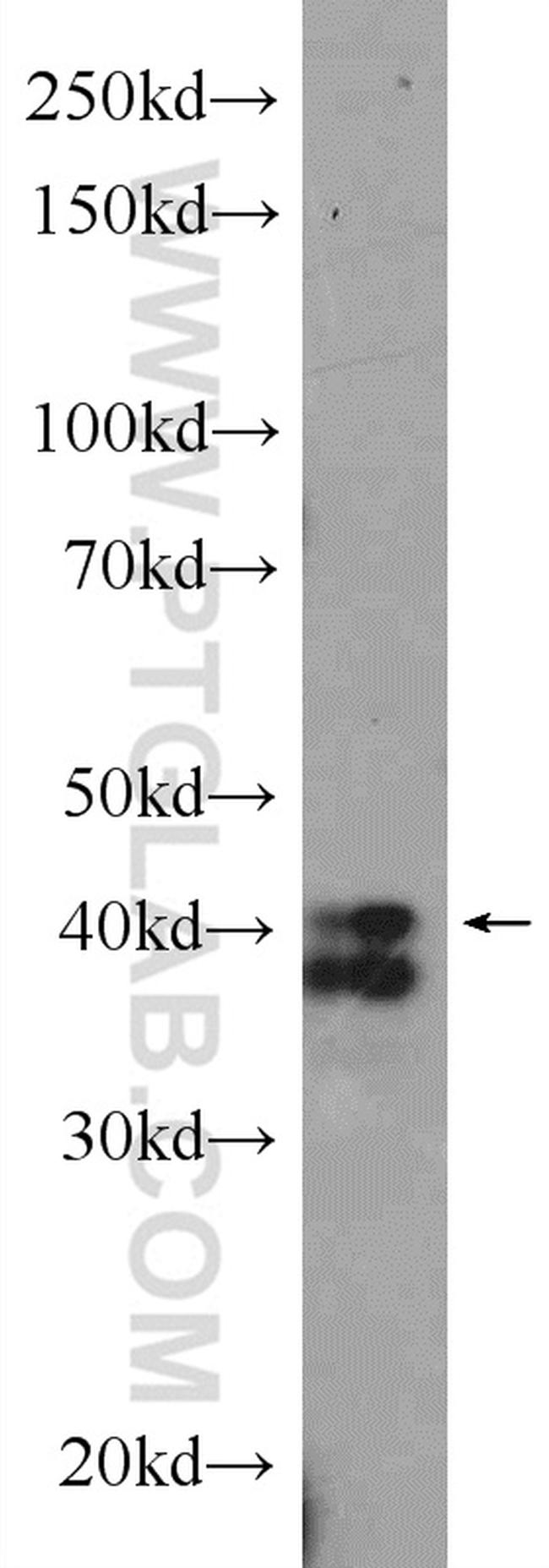 TIA1 Antibody in Western Blot (WB)