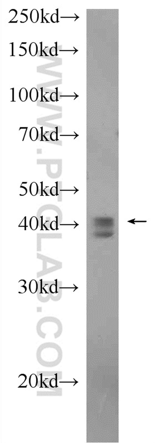 TIA1 Antibody in Western Blot (WB)