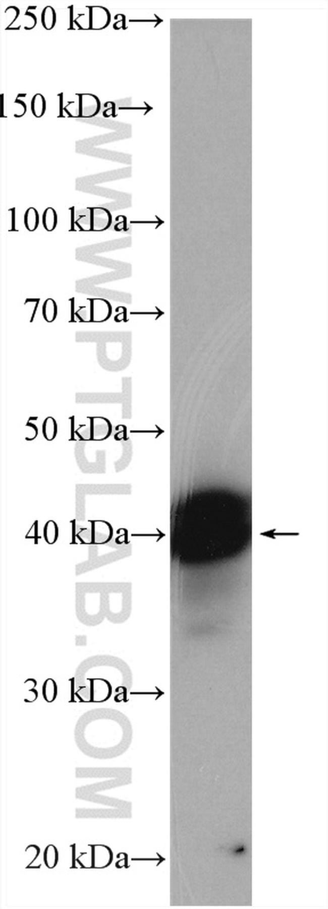 TIA1 Antibody in Western Blot (WB)