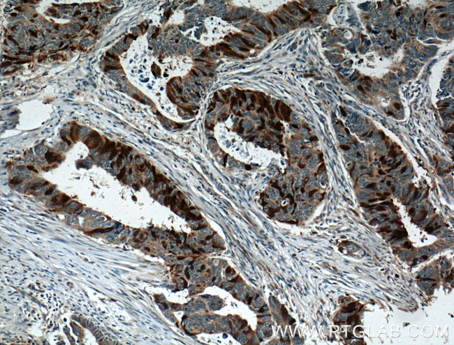 UBE2C Antibody in Immunohistochemistry (Paraffin) (IHC (P))