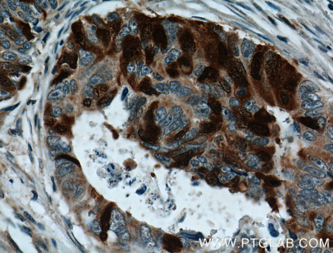 UBE2C Antibody in Immunohistochemistry (Paraffin) (IHC (P))