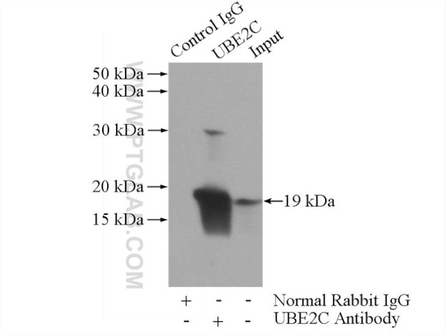 UBE2C Antibody in Immunoprecipitation (IP)