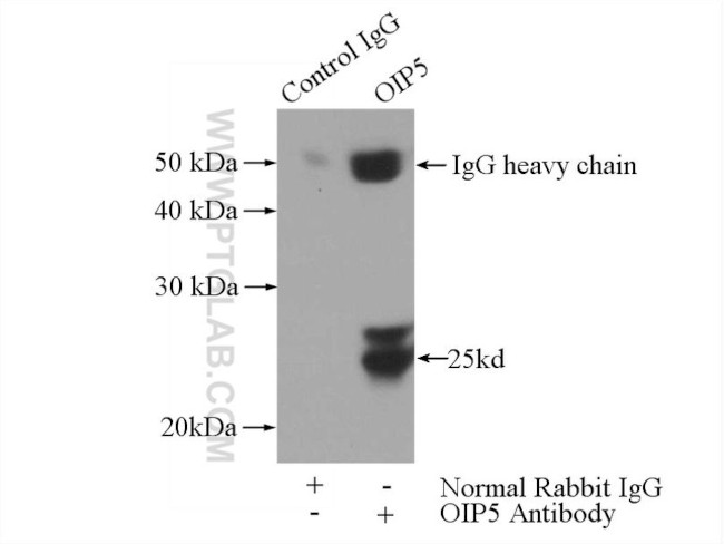 OIP5 Antibody in Immunoprecipitation (IP)