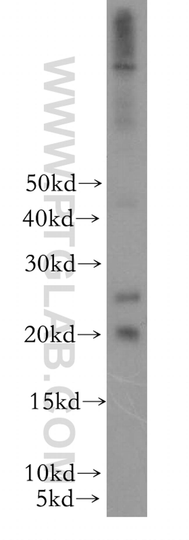 OIP5 Antibody in Western Blot (WB)