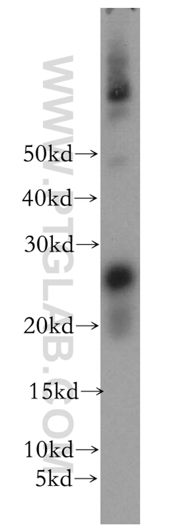 OIP5 Antibody in Western Blot (WB)