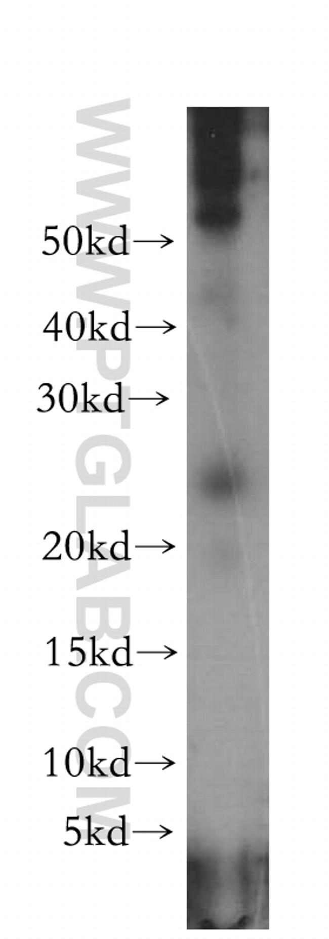 OIP5 Antibody in Western Blot (WB)