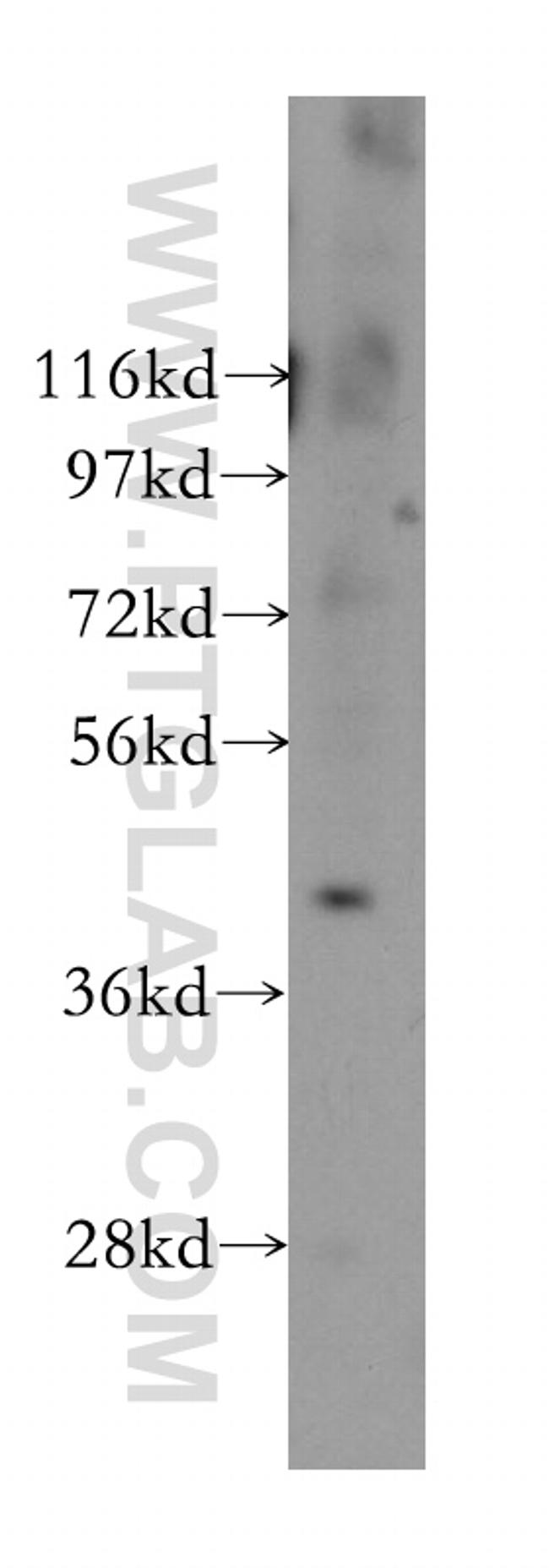 NEIL1 Antibody in Western Blot (WB)