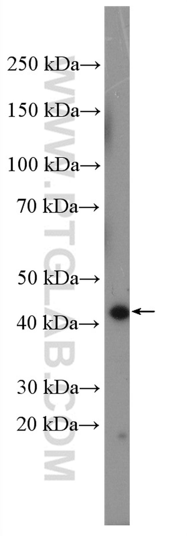 NEIL1 Antibody in Western Blot (WB)