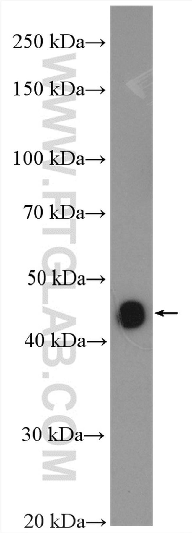 NEIL1 Antibody in Western Blot (WB)