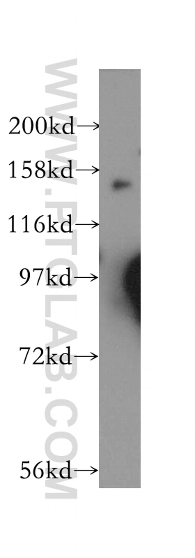 GAK Antibody in Western Blot (WB)