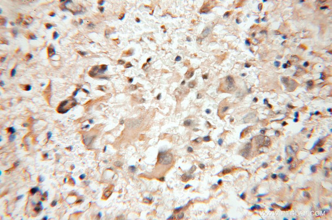 PTS Antibody in Immunohistochemistry (Paraffin) (IHC (P))