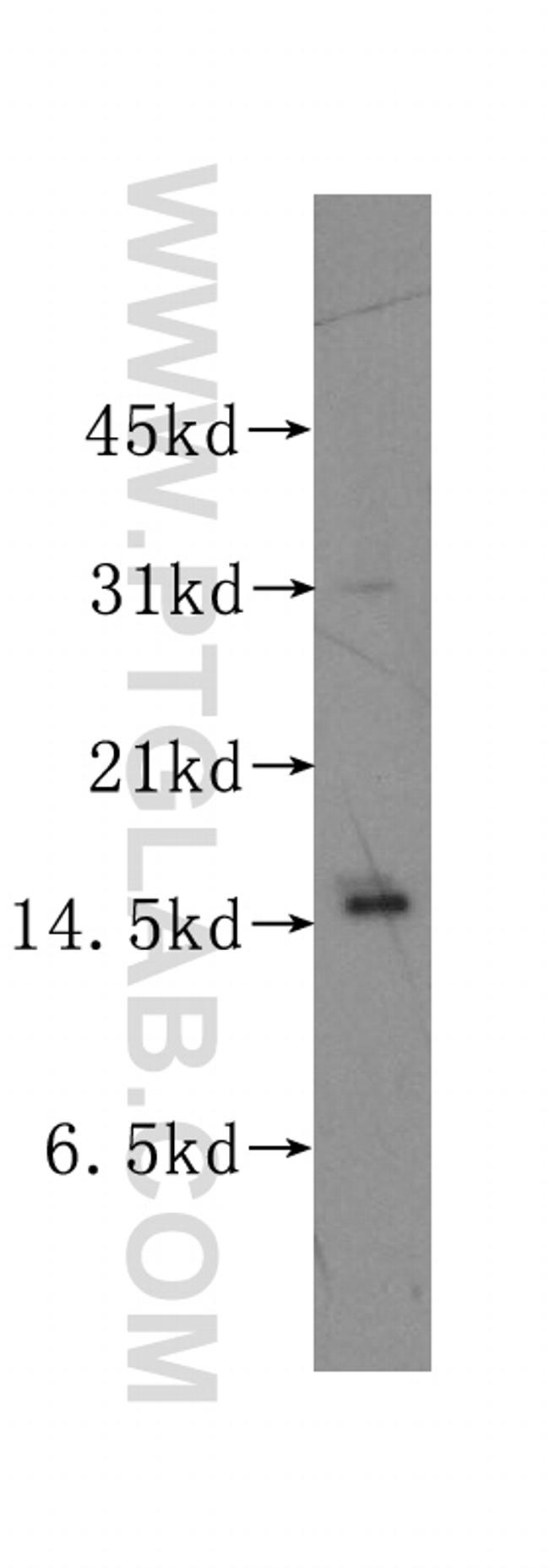 PTS Antibody in Western Blot (WB)