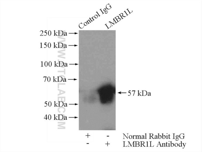 LMBR1L Antibody in Immunoprecipitation (IP)