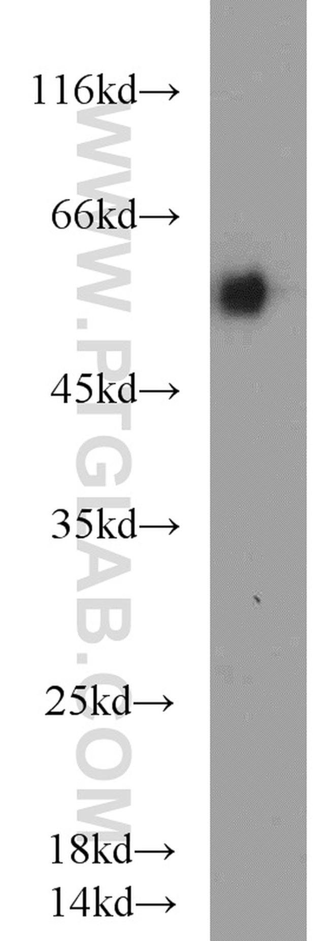 LMBR1L Antibody in Western Blot (WB)