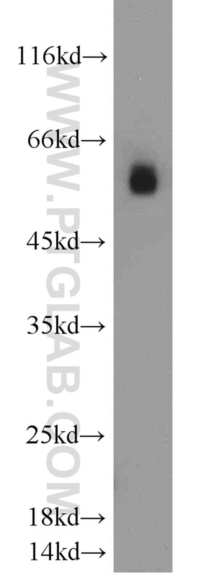 LMBR1L Antibody in Western Blot (WB)