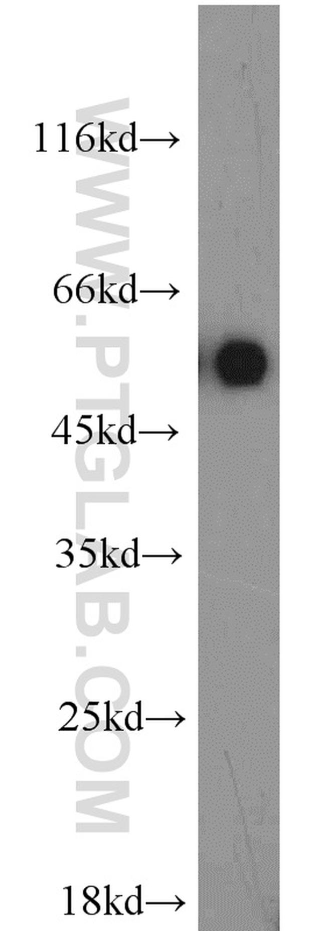 LMBR1L Antibody in Western Blot (WB)