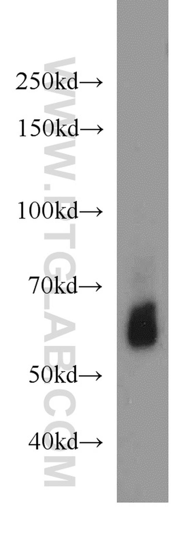 LMBR1L Antibody in Western Blot (WB)