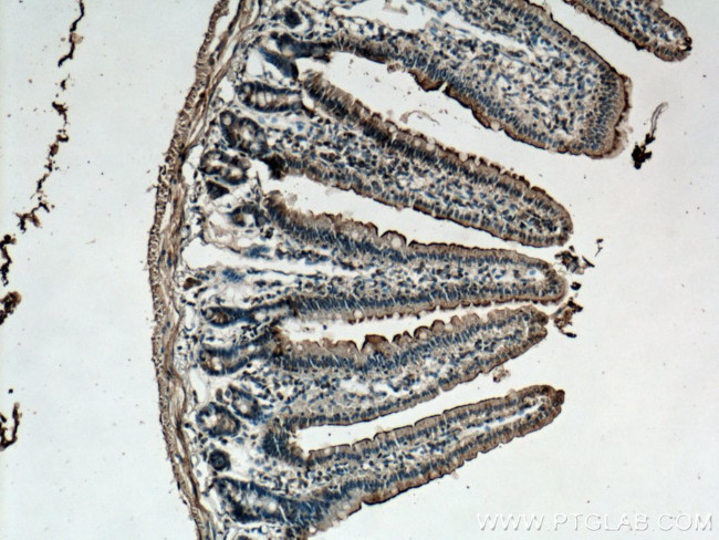 TCN2 Antibody in Immunohistochemistry (Paraffin) (IHC (P))