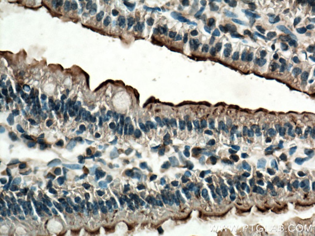 TCN2 Antibody in Immunohistochemistry (Paraffin) (IHC (P))